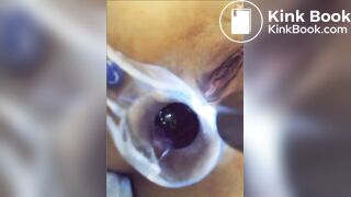 You can see her shit in her asshole?