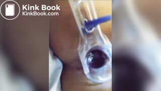 You can see her shit in her asshole?