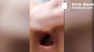 Open anus with poo close up