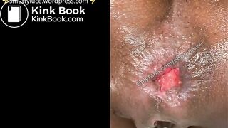 SHITTING & TWERKING AT THE SAME DAMN TIME - Prolap