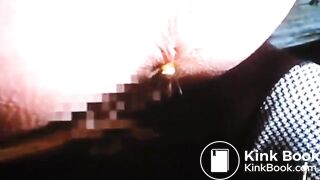 she has stomach pain and a lot of diarrhea