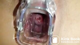 Stuffing Pussy With Shit - Scat Play