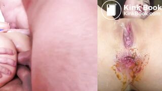 MEGA MIX ANAL - SCAT - video 2