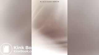 Giant constipation - video 2