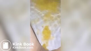 Scat Diarrhea in Pool