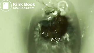 My girlfriend's poop 15
