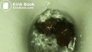 My girlfriend's poop 15