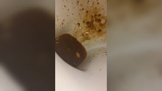 Female runny diarrhea