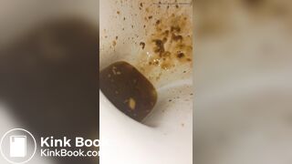 Female runny diarrhea