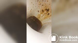 Female runny diarrhea