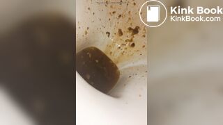 Female runny diarrhea