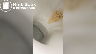 Female runny diarrhea