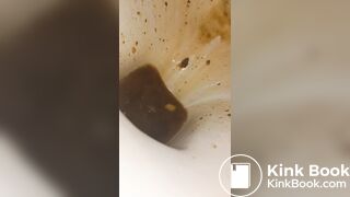 Female runny diarrhea