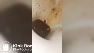 Female runny diarrhea