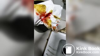 Chinese doctor diarrhea part3