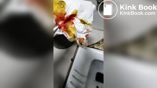 Chinese doctor diarrhea part3