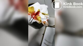 Chinese doctor diarrhea part3