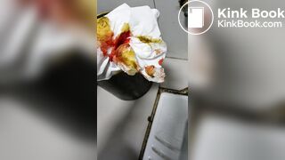 Chinese doctor diarrhea part3