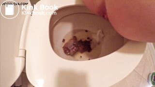 Alexa needs to poop urgently