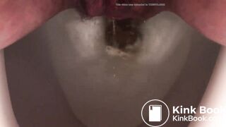 Gaping Hairy Pussy Shit 3