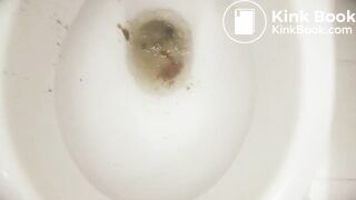 at the airport before departure she had diarrhea