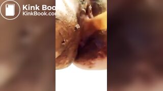 Gf fucking her poop filled pussy