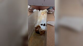 Chinese girl with diarrhea after eating barbecue