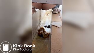 Chinese girl with diarrhea after eating barbecue