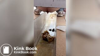 Chinese girl with diarrhea after eating barbecue