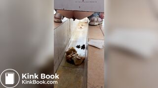 Chinese girl with diarrhea after eating barbecue