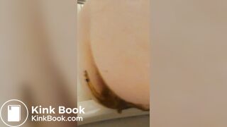 Pooping again after anal sex