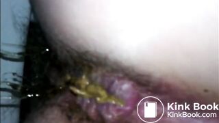 Hairy ass and soft shit