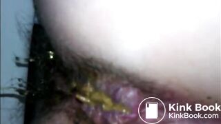 Hairy ass and soft shit