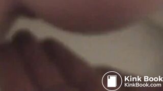 diarrhea in hand complication