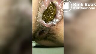 Closeup of Two Hard Nuggets of Poop in the Toilet