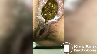 Closeup of Two Hard Nuggets of Poop in the Toilet