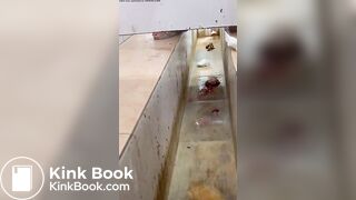 Chinese girl with large amount of diarrhea