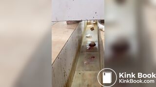 Chinese girl with large amount of diarrhea