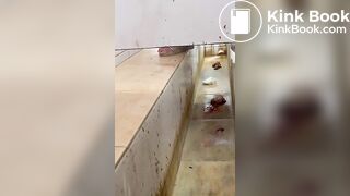 Chinese girl with large amount of diarrhea