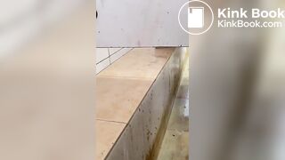 Chinese girl with large amount of diarrhea