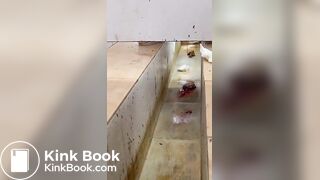 Chinese girl with large amount of diarrhea