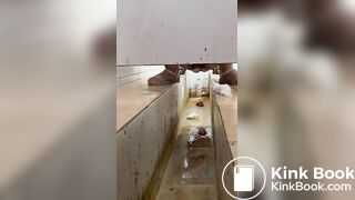 Chinese girl with large amount of diarrhea