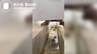 Chinese girl with large amount of diarrhea