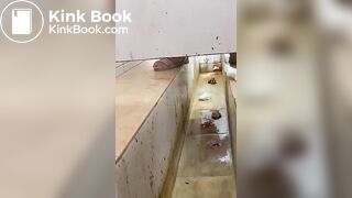 Chinese girl with large amount of diarrhea