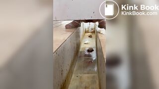 Chinese girl with large amount of diarrhea