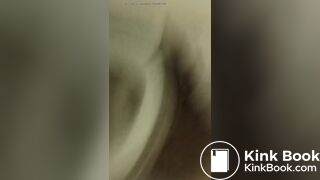 Girl run too poop