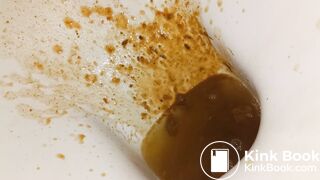 Girl diarrhea - video 8