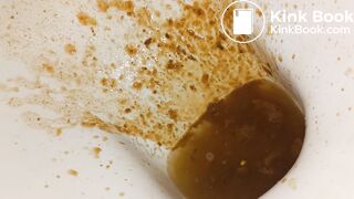 Girl diarrhea - video 8