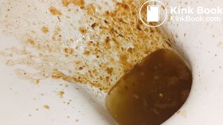 Girl diarrhea - video 8