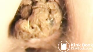Constipation Compilation - video 2